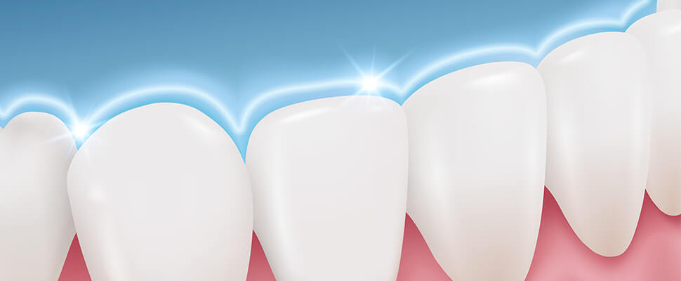 general fluoride treatments offered in Hebron KY