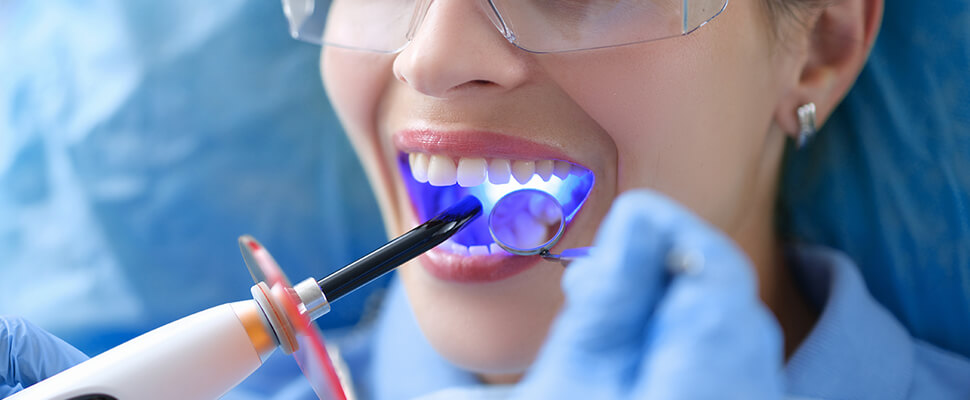 dental sealant being applied for a patient in Hebron KY