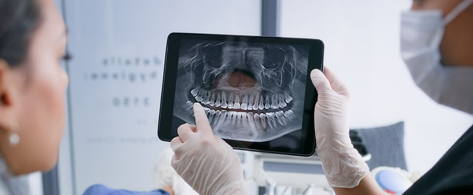 detailed dental xray services in hebron ky